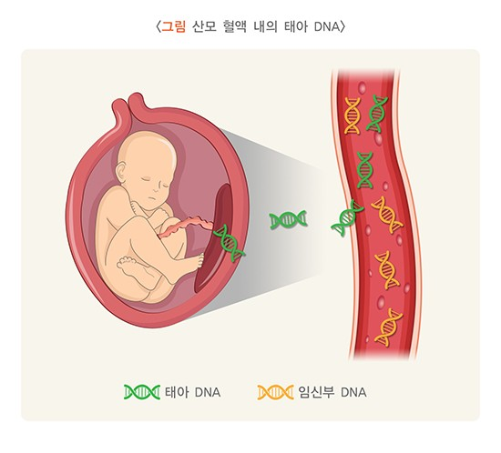 니프티 검사